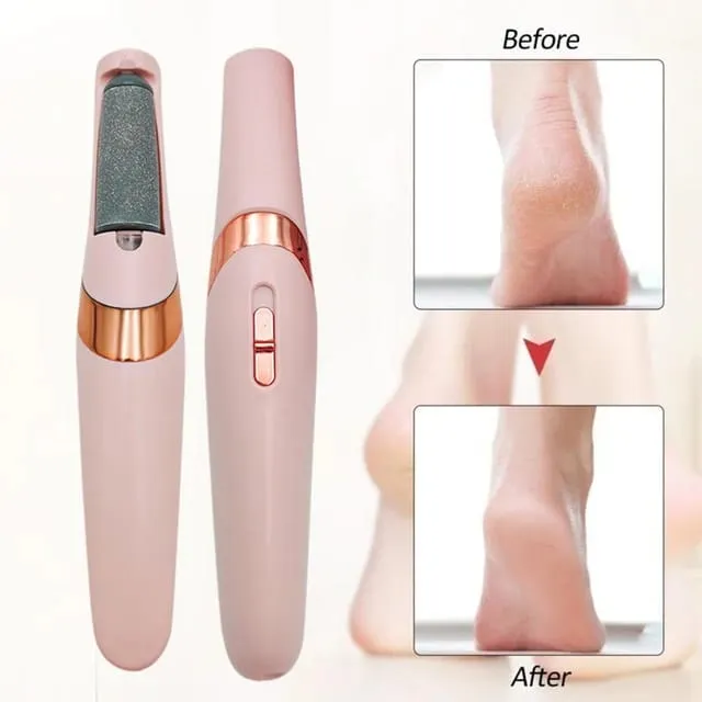 Electric Foot Callus Remover